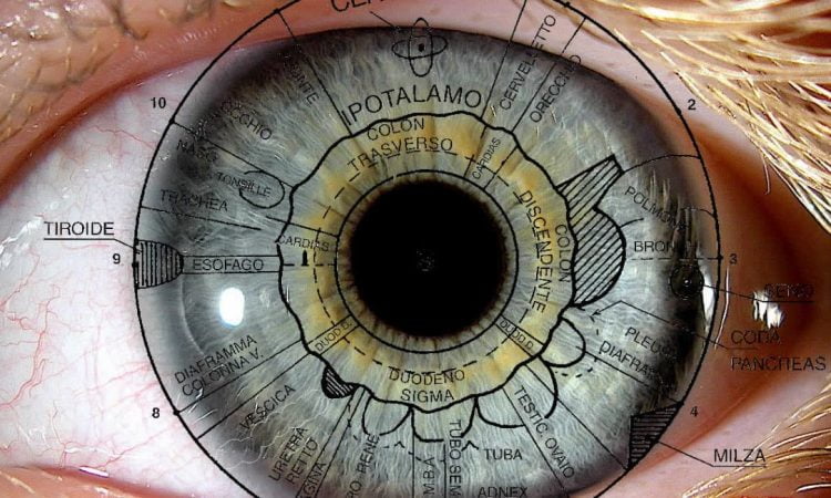 iridologia iridologia